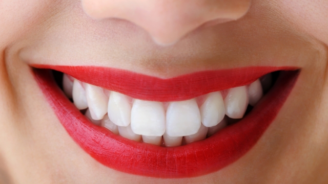 Unlocking a Dazzling Smile: The Ultimate Guide to Teeth Whitening